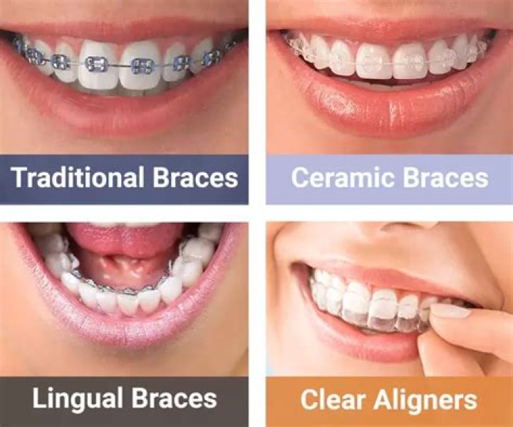 Are ceramic braces more painful?