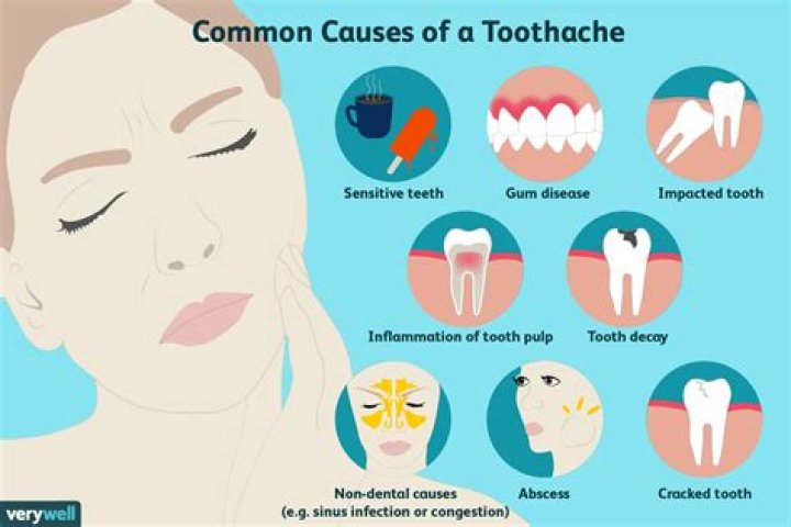 Can a bad tooth cause an earache?