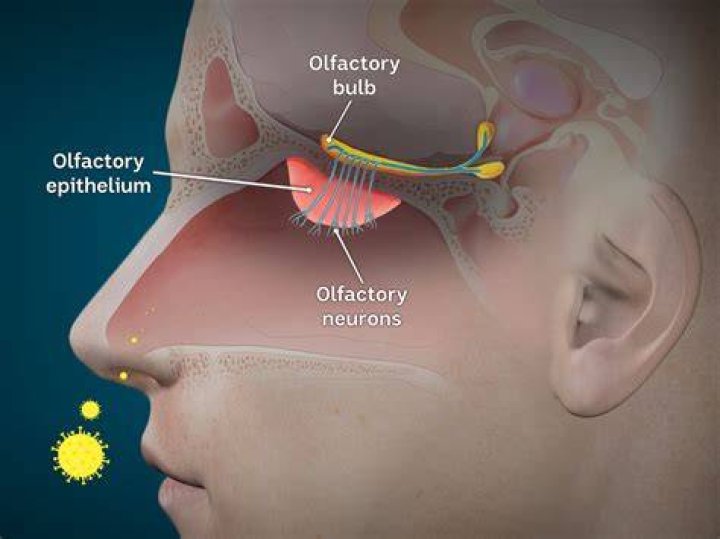 Can a brain bleed come out your nose?