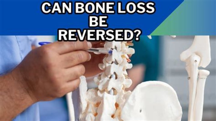 Can bone loss be reversed?