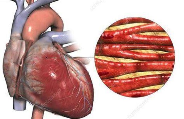 Can heart damage be repaired?