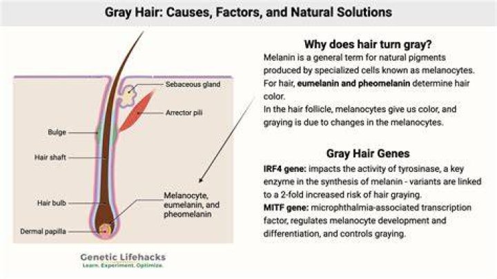 Can less sleep cause grey hair?
