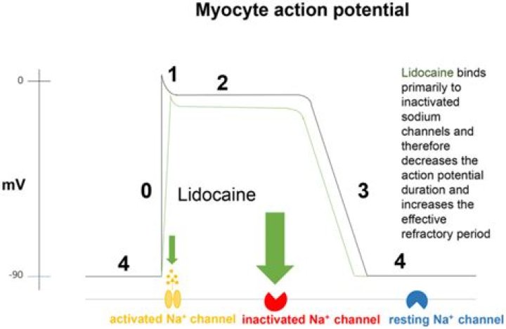 Can lidocaine affect the heart?