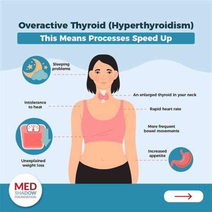 Can thyroid cause irregular heartbeat?