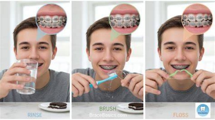 Can u eat Oreos with braces?