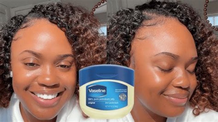 Can Vaseline help Crepey?