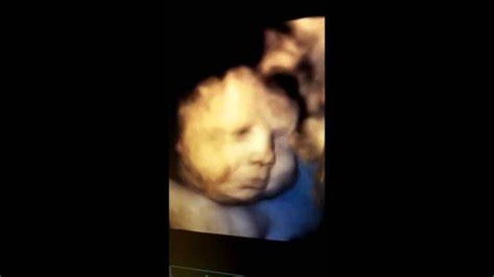 Do babies cry while in the womb?