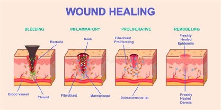 Do burns heal faster covered or uncovered?