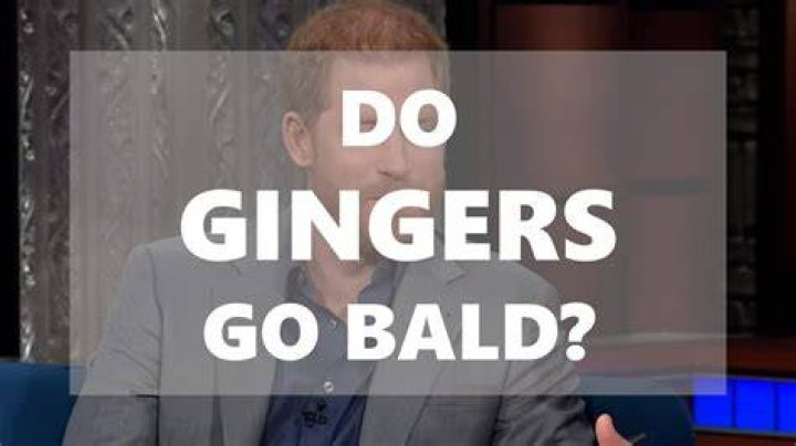 Do gingers go bald quicker?