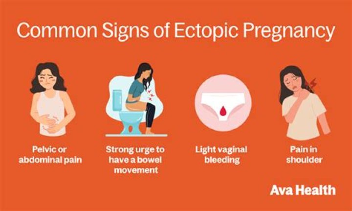 Do you have constant pain with ectopic pregnancy?