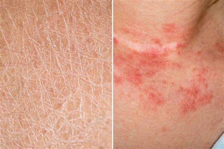 Does dry skin mean your having a boy or girl?