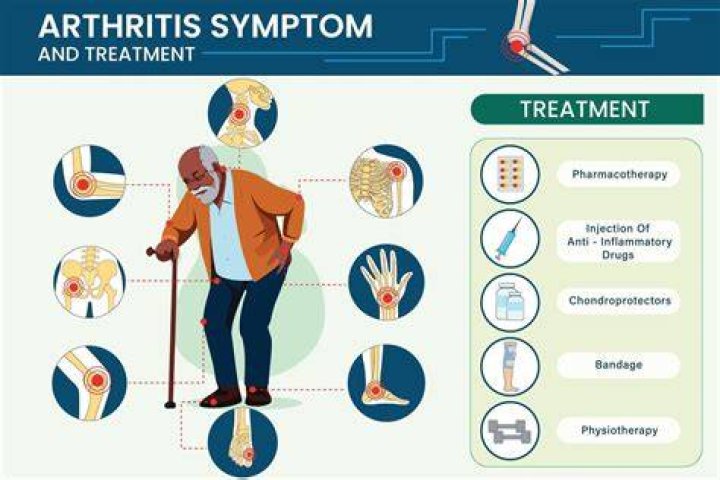 Does having arthritis hurt all the time?