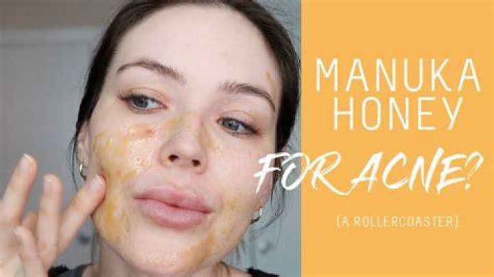 Does honey remove pigmentation?