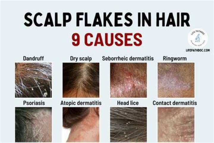 Does methotrexate make your hair fall out?