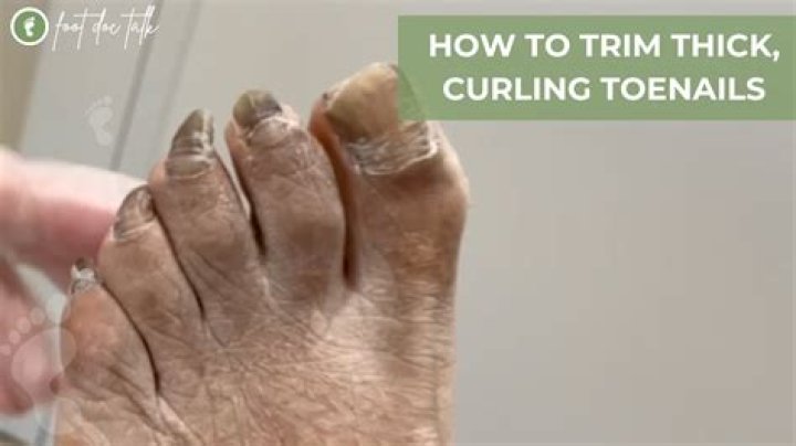 How do I cut my thick toenails?