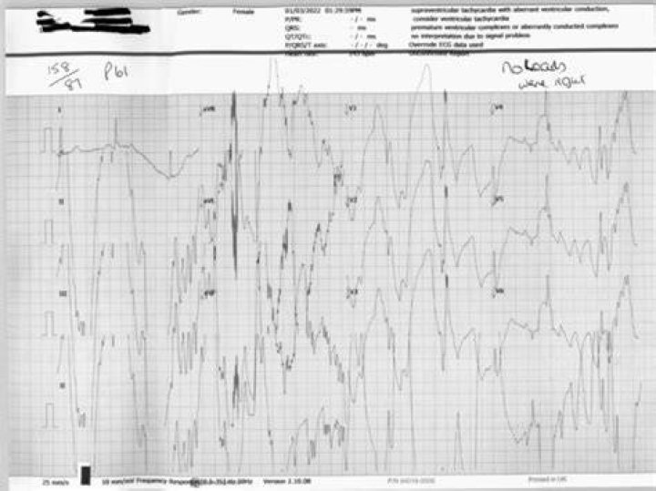How do I fix poor signal quality?