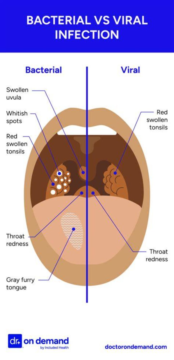 How do I know if my child has a viral or bacterial infection?