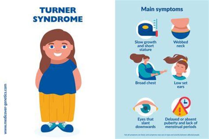 How do you get Turner syndrome?