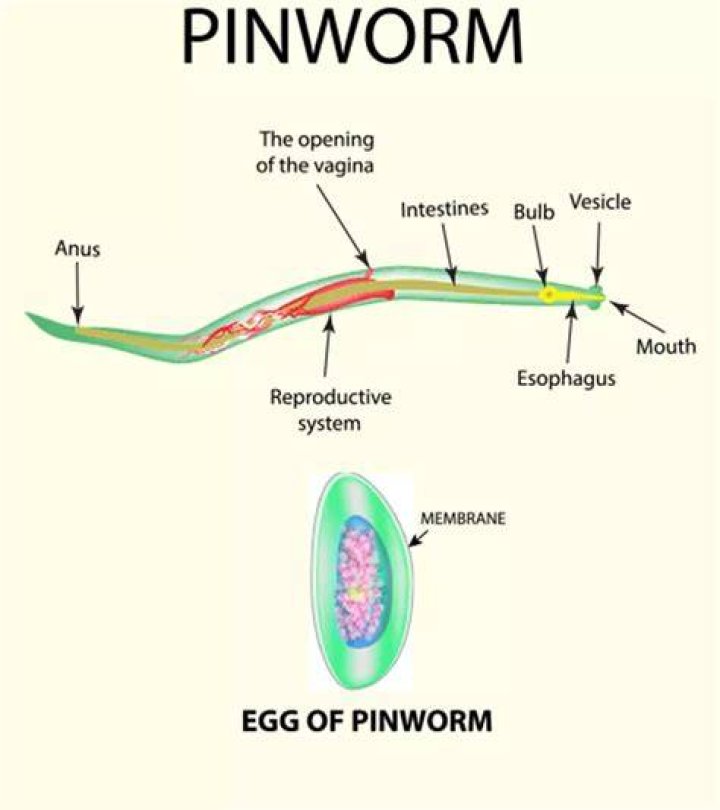 How does pinworm look like?
