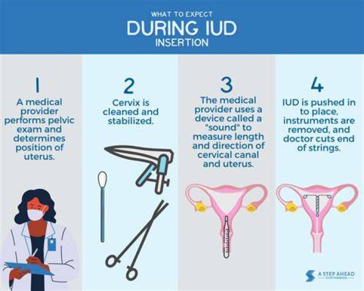 How long does the pain last after IUD insertion?
