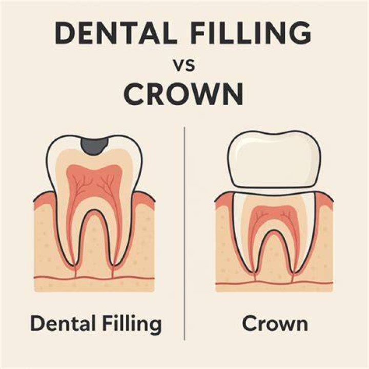 Is a crown more painful than a filling?