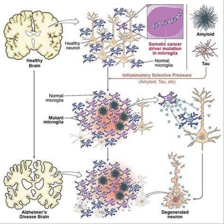 Is Alzheimer's inherited from the mother?
