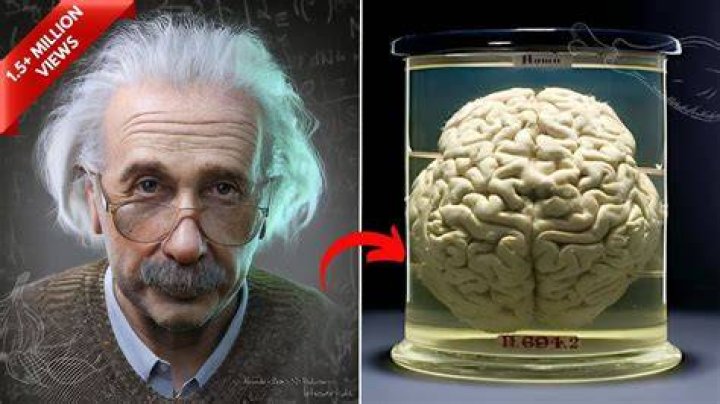 Was Einstein's brain different?
