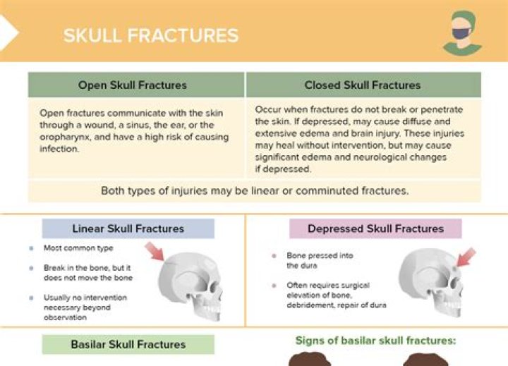 What are 4 types of skull fractures?