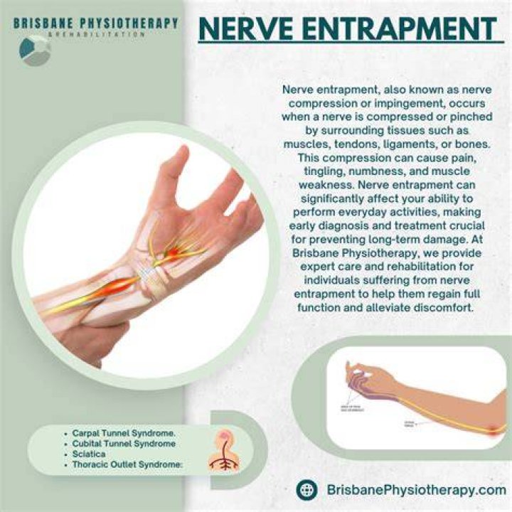 What are entrapment neuropathies?