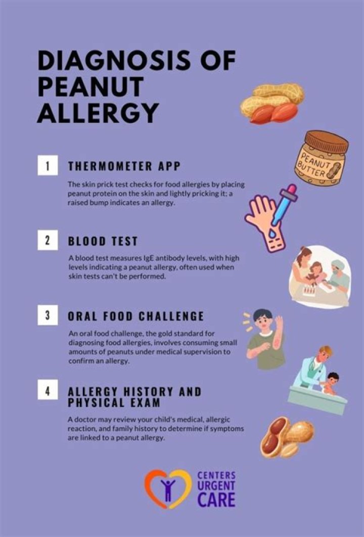 What are peanut allergy symptoms?
