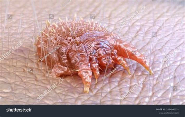 What are Scabie mites?