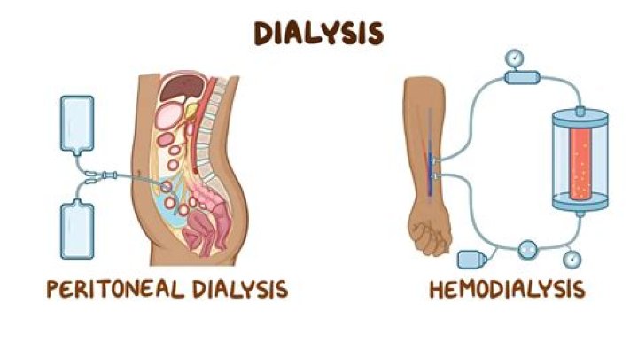 What are the 3 types of dialysis?