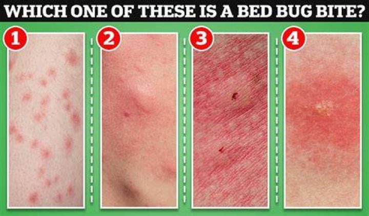 What bugs bite at night in bed?