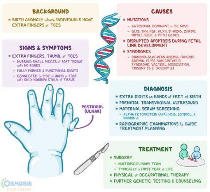 What causes baby born with extra thumb?