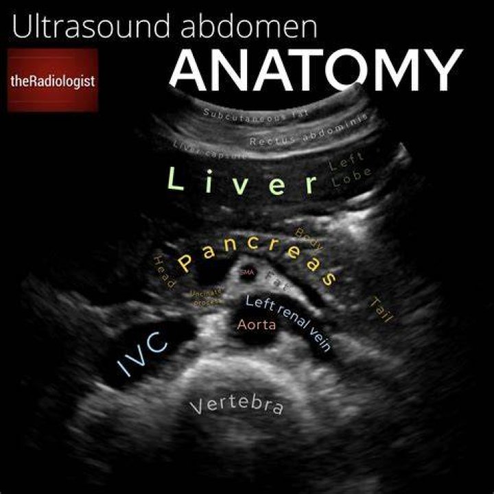 What does a complete abdominal ultrasound look at?