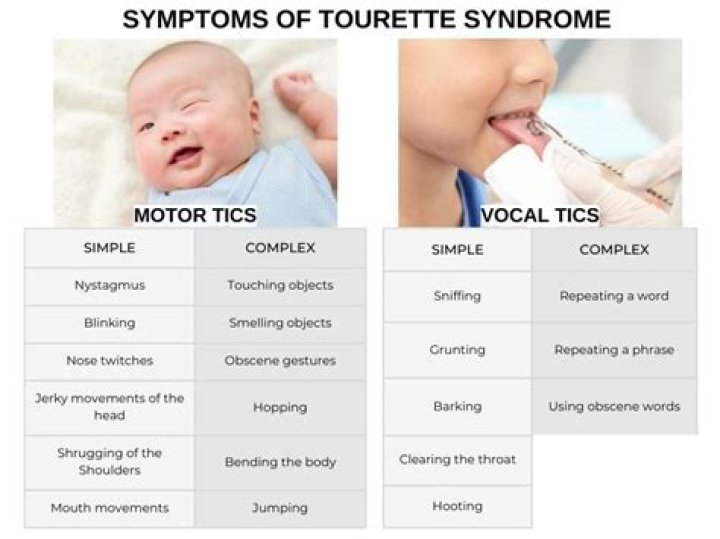 What does Tourette's look like in a child?