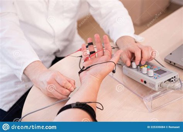 What is a nerve test on your hand?
