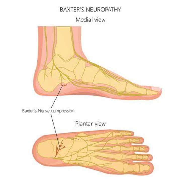 What is Baxter's nerve?