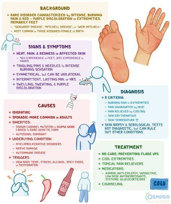 What is Hot feet Syndrome?