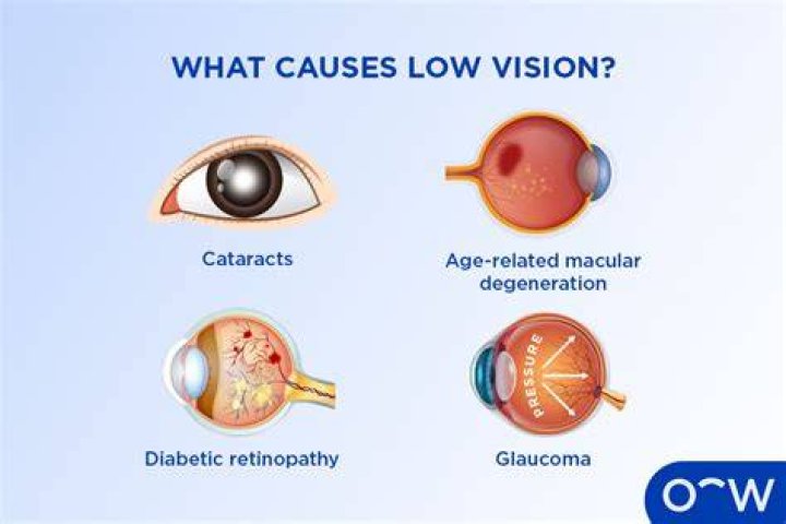 What is the cause of poor eyesight?