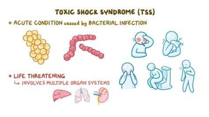 What is toxic venting?