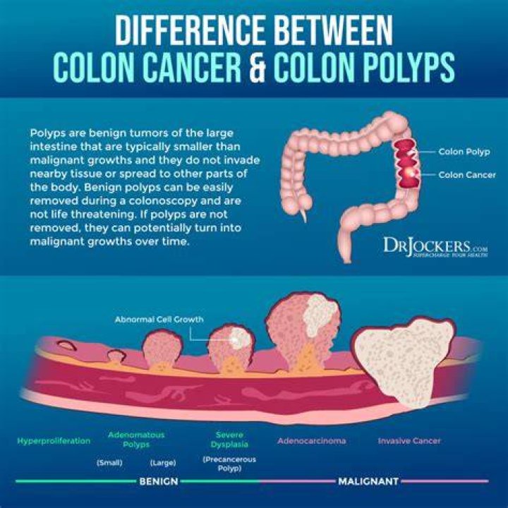 What kills colon polyps?