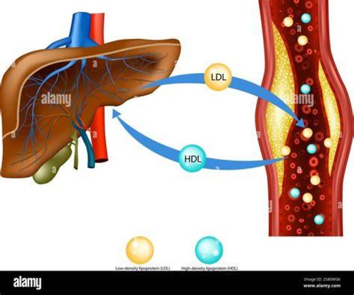 What liver disease causes high cholesterol?