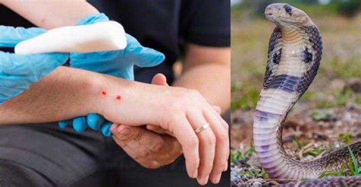 What to do if you get bitten by a king cobra?