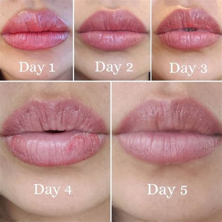 When do lips stop growing?