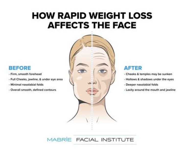 When do you lose weight in your face?