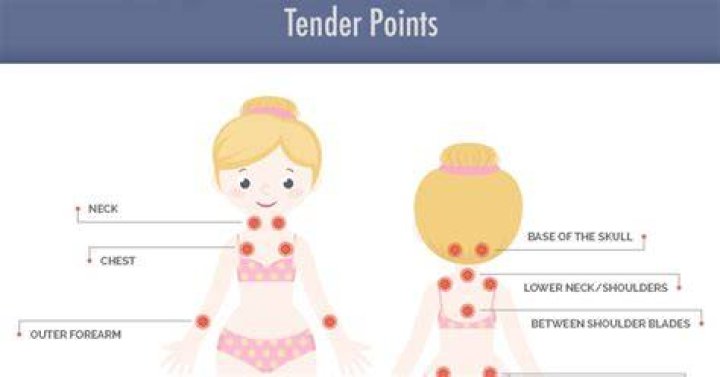 Where are the tender points of fibromyalgia?