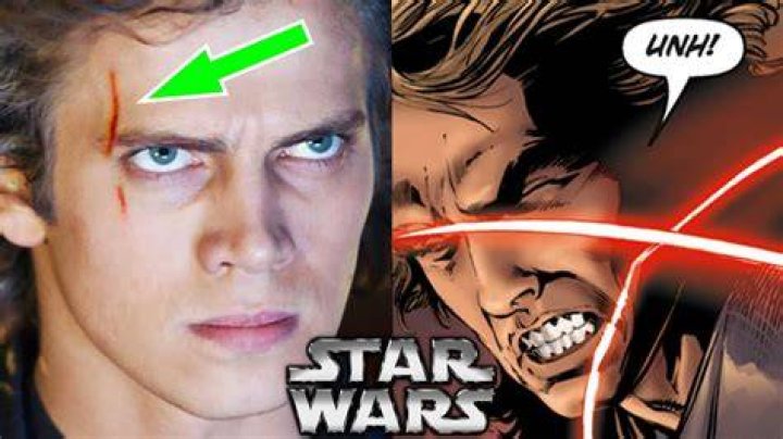 Where does Anakin get his scar?