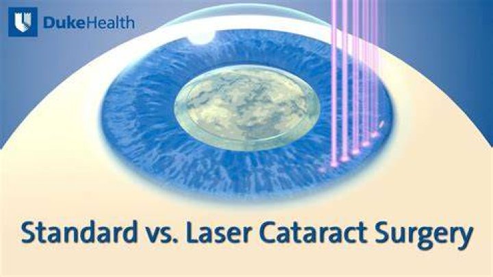 Which is better laser cataract surgery or regular cataract surgery?