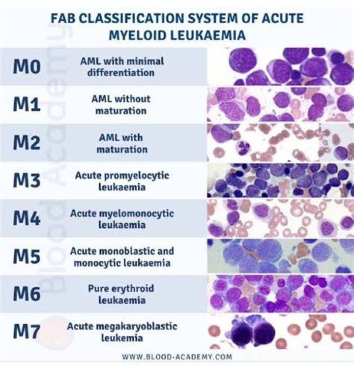 Which type of leukemia is most fatal?